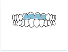 深圳牙齒矯正價錢