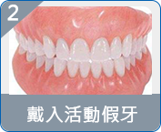 香港allon4種植牙推薦