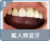 羅湖全口重建邊度好
