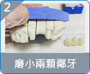 羅湖全口重建邊度好