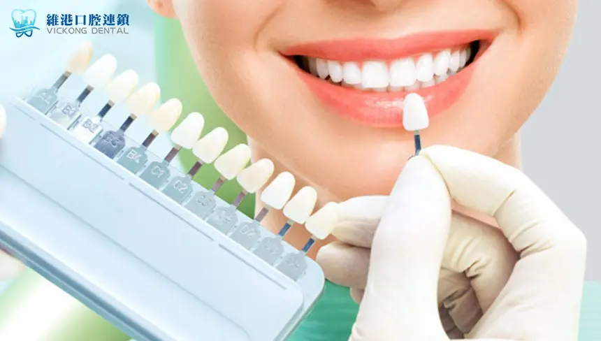 深圳牙齒美白價錢