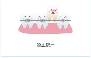 深圳拔智慧齒推薦
