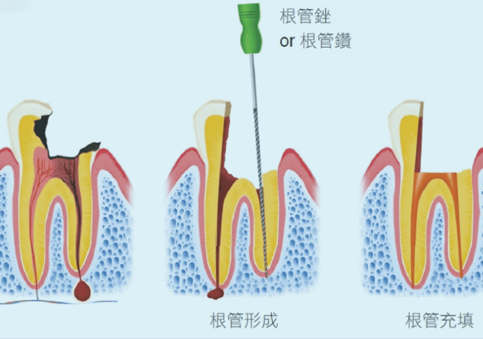深圳杜牙根